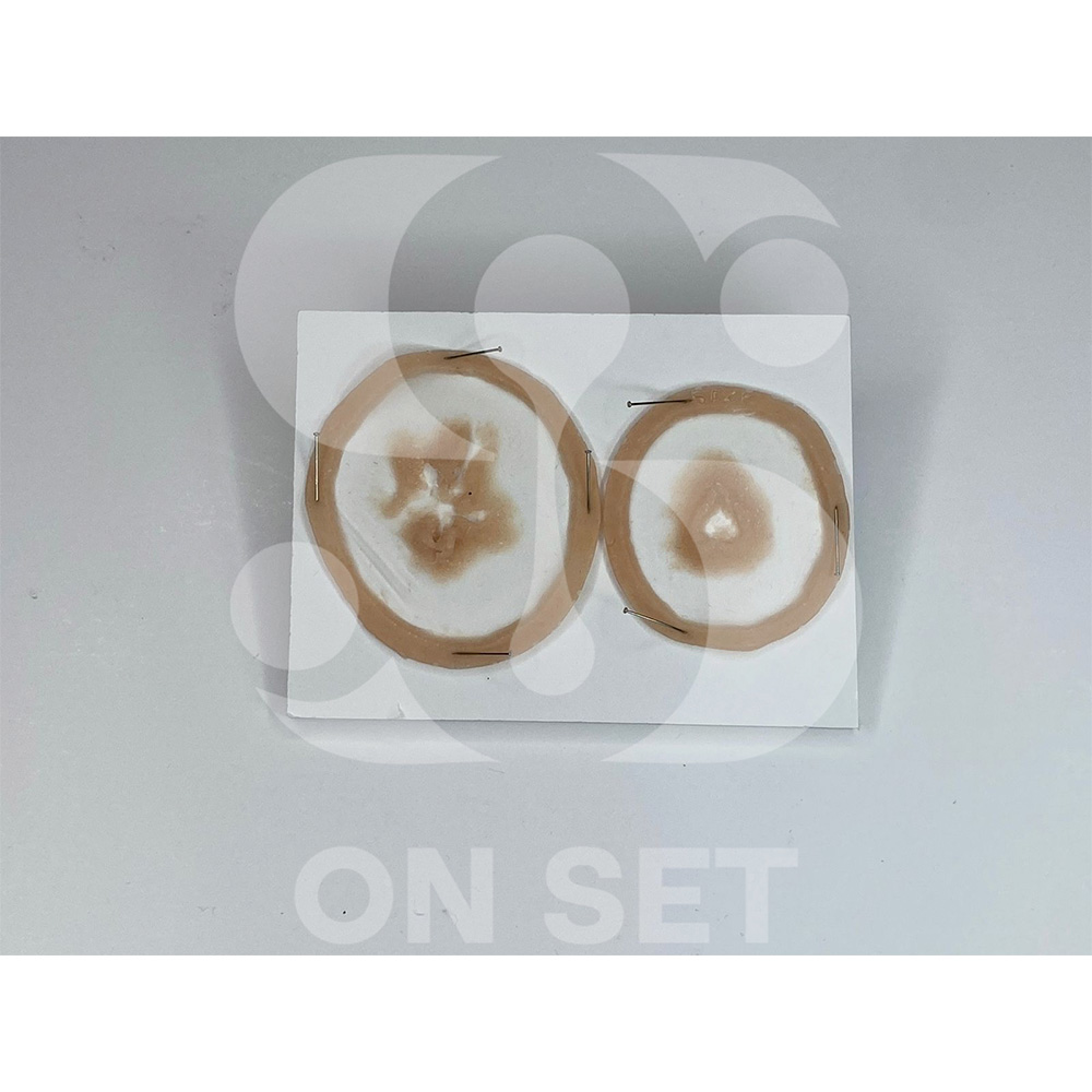 (ONSET) Prostético de Balazos