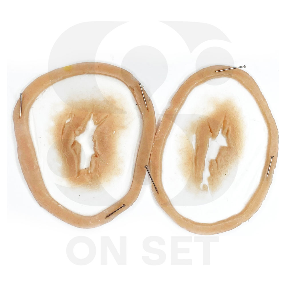 (ONSET) Prostético de Heridas Pequeñas