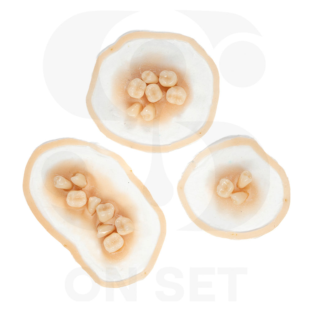 (ONSET) Prostético de Dientes