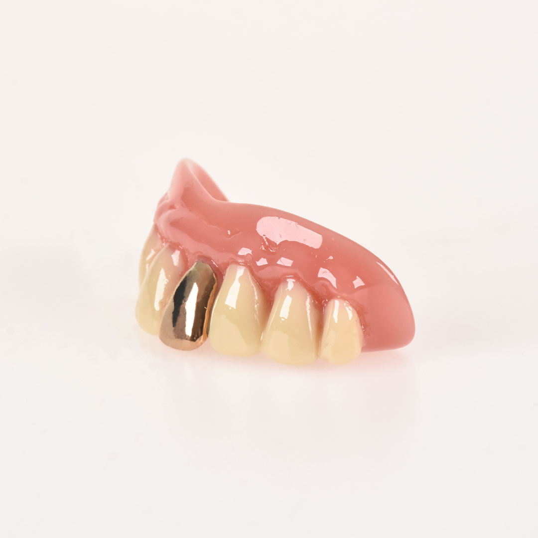 10052 Dientes con Diente de Oro