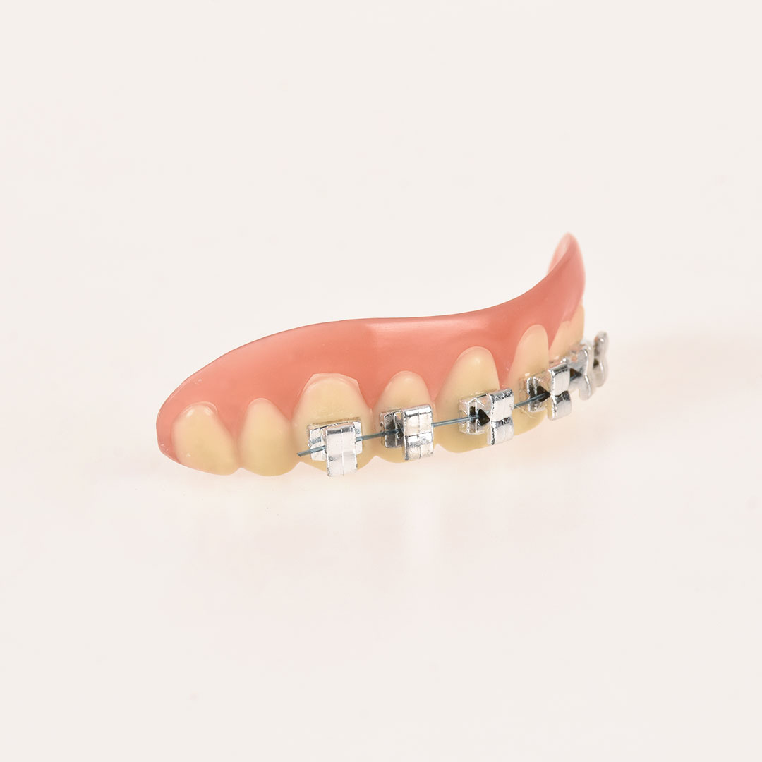 10112 Dientes con Brackets