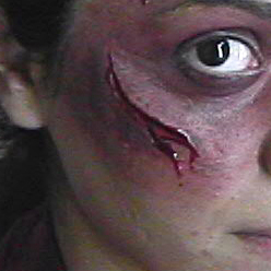 Cicatriz Mod. 2 cortada 