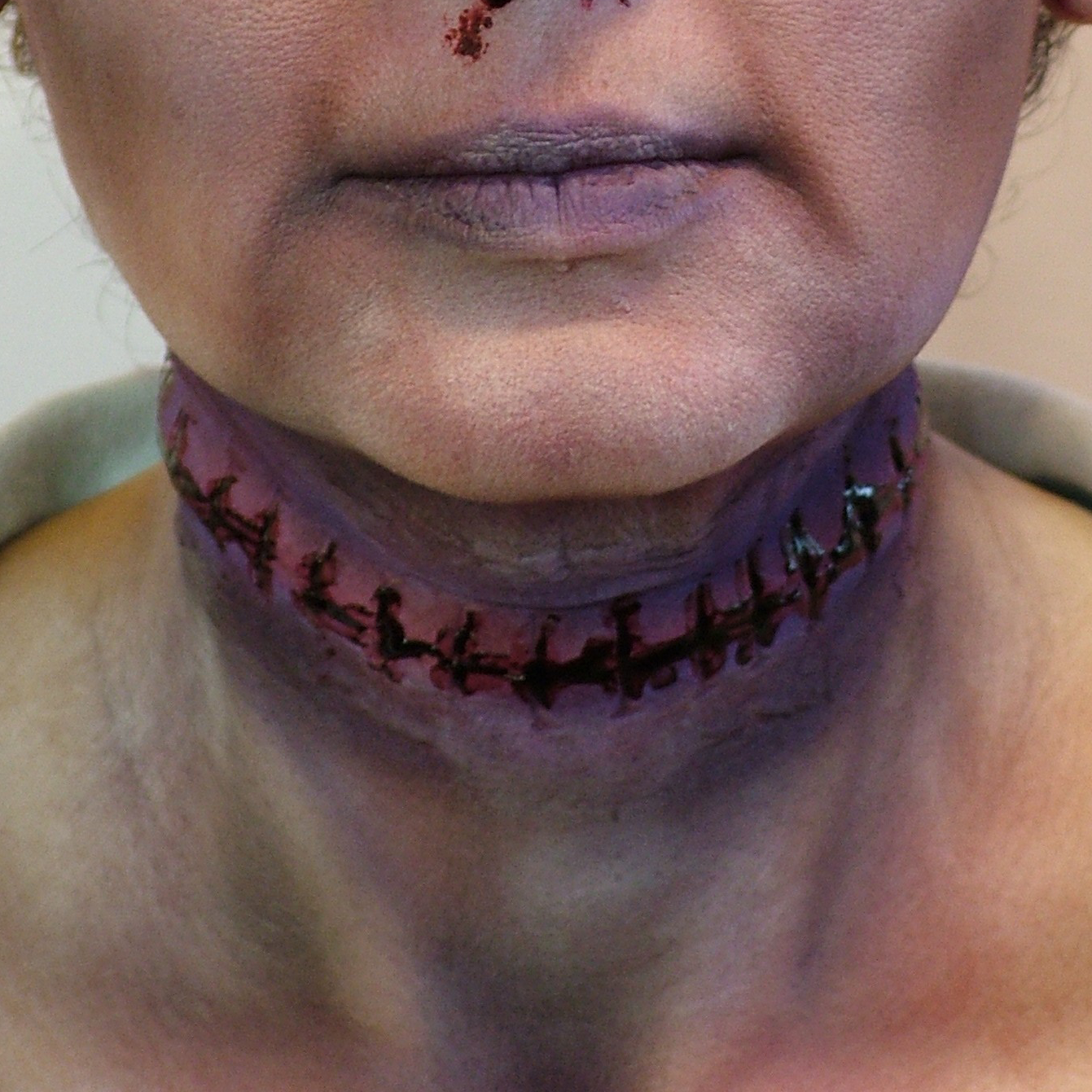 Cicatriz Mod. 8 cicatriz grande