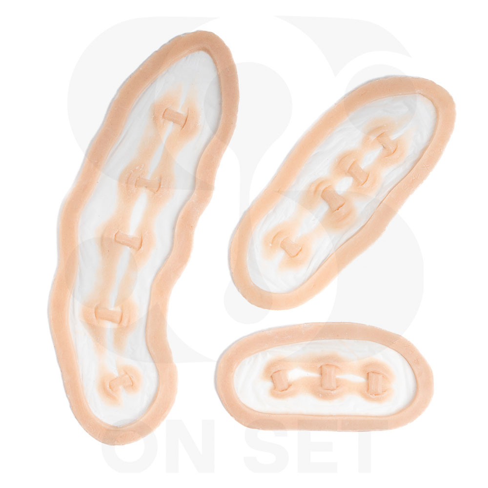 Prostético de Suturas de Frankenstein