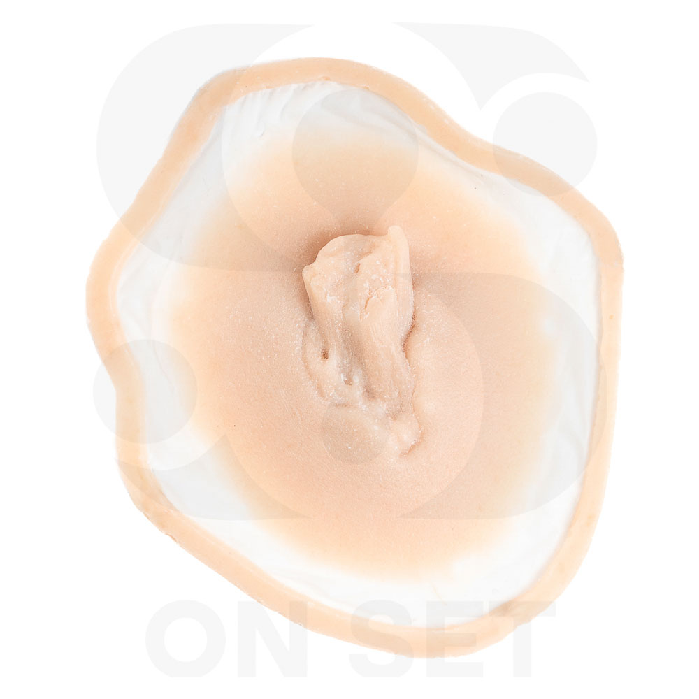 Prostético de Fractura Expuesta