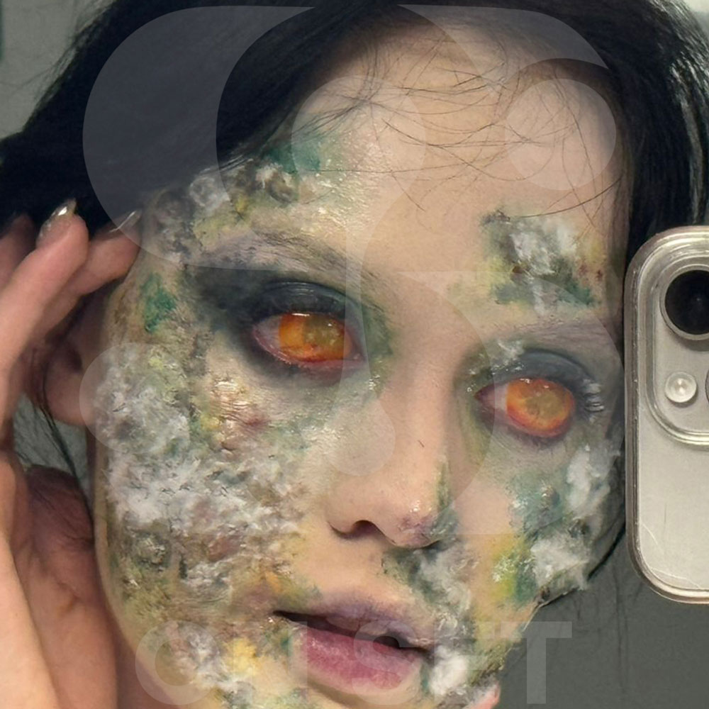 (ONSET) Prostético de Infección/ámpulas