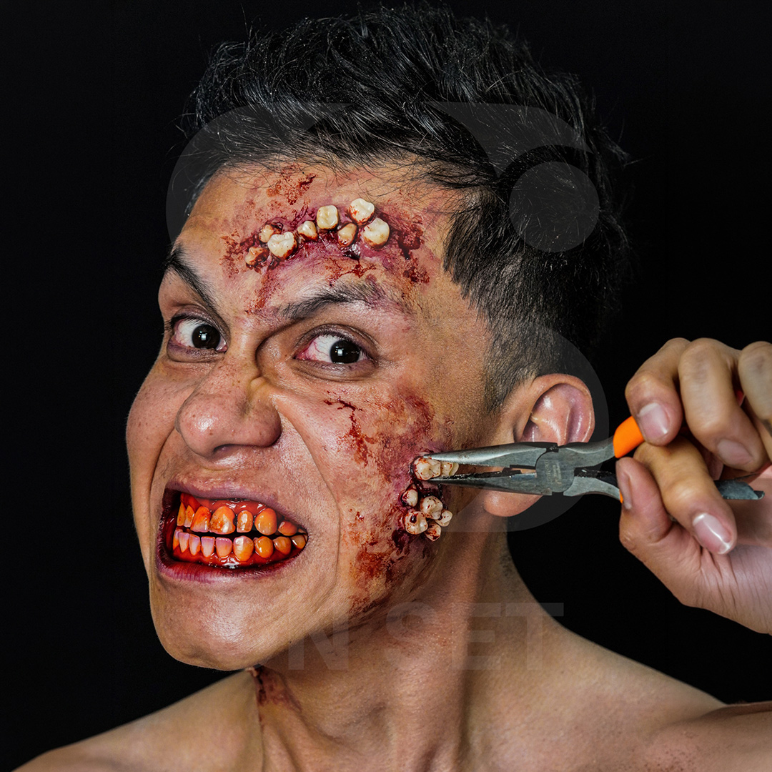 (ONSET) Prostético de Dientes
